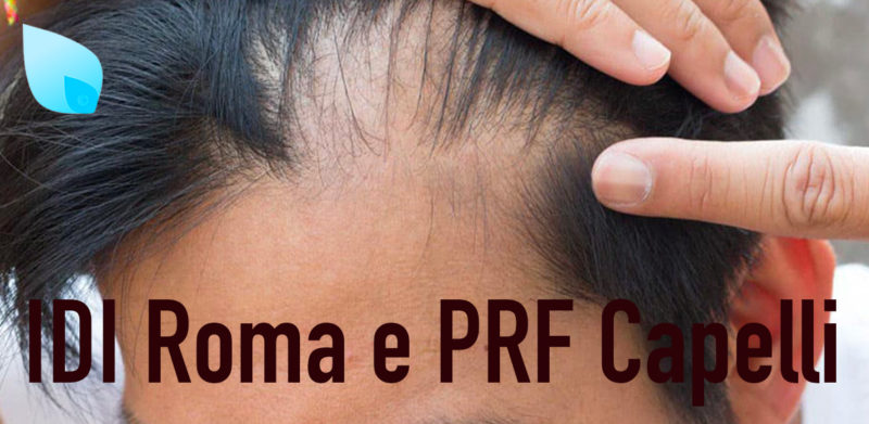 IDI Roma e PRF Capelli