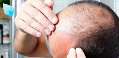 Alopecia e Invecchiamento