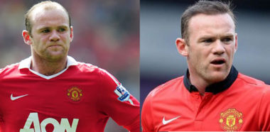 Trapianto Capelli Rooney